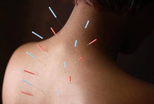 Acupuncture-bodymindwellness.com